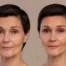 A before and after image for beauty treatments.