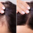 Before and After