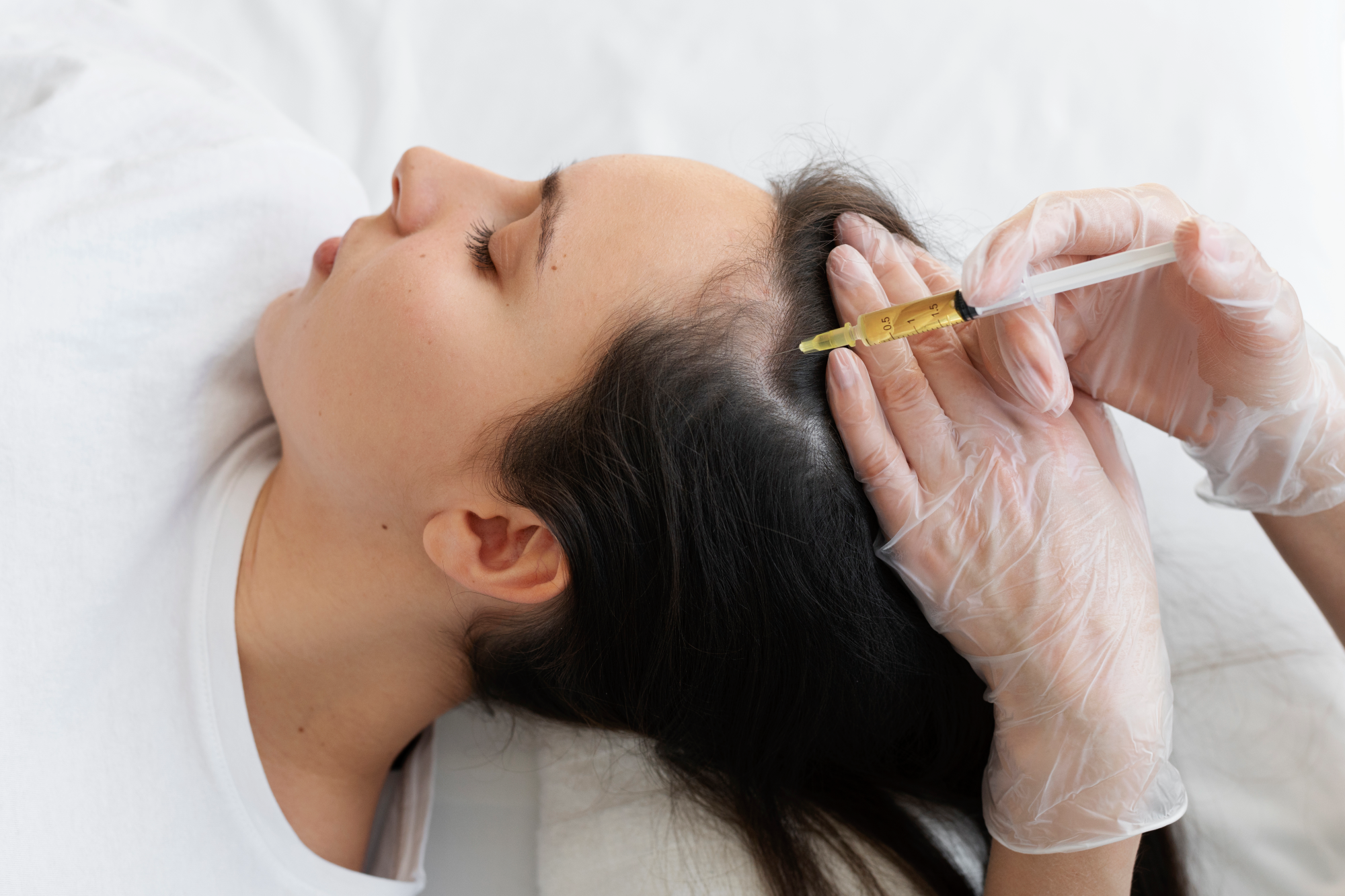 woman-getting-scalp-prp-treatment-high-angle